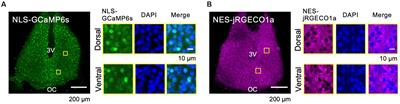 In-phasic cytosolic-nuclear Ca2+ rhythms in suprachiasmatic nucleus neurons